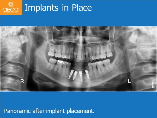 Clinical Case