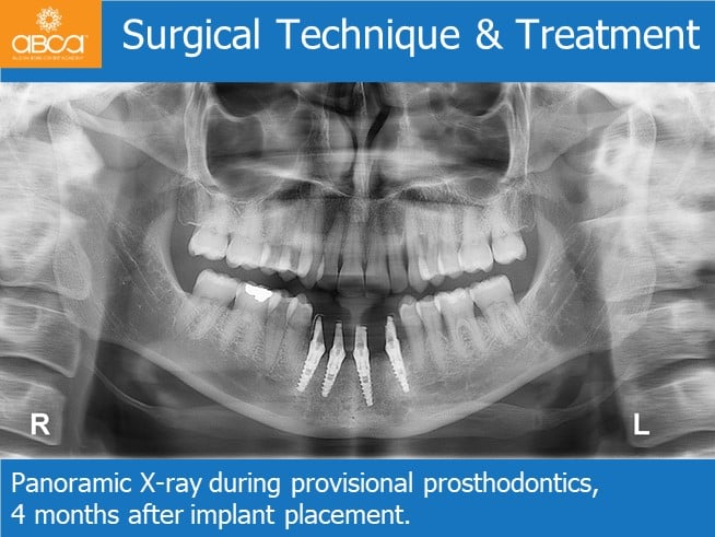 Clinical Case