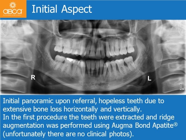 Clinical Case