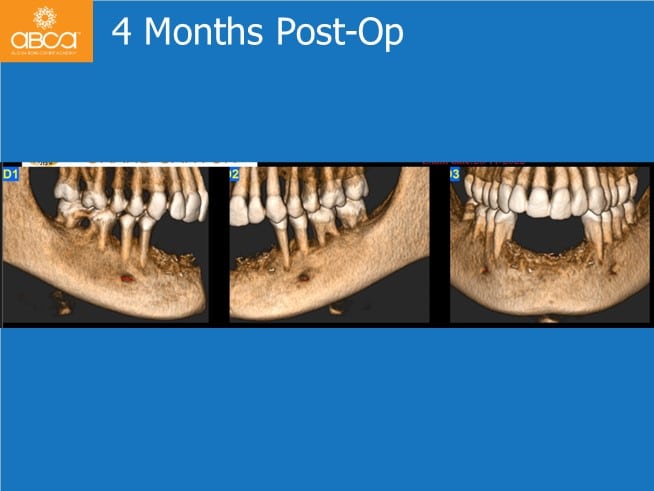 Clinical Case