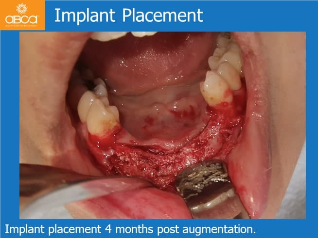 Clinical Case