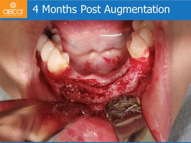 Clinical Case