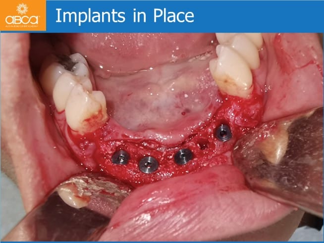 Clinical Case