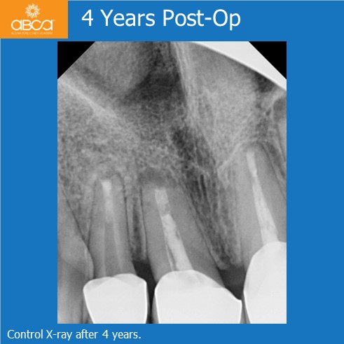 Clinical Case