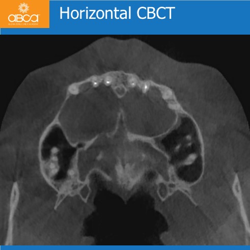 Clinical Case