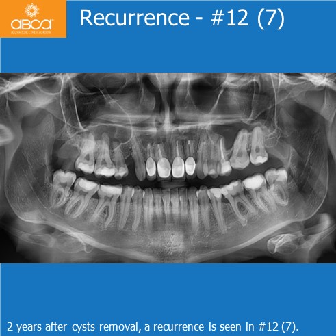 Clinical Case