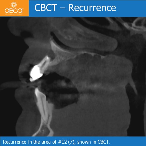 Clinical Case