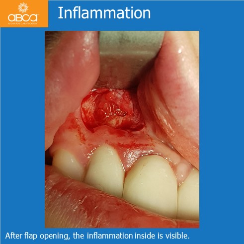 Clinical Case