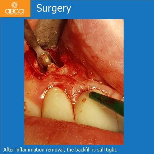 Clinical Case