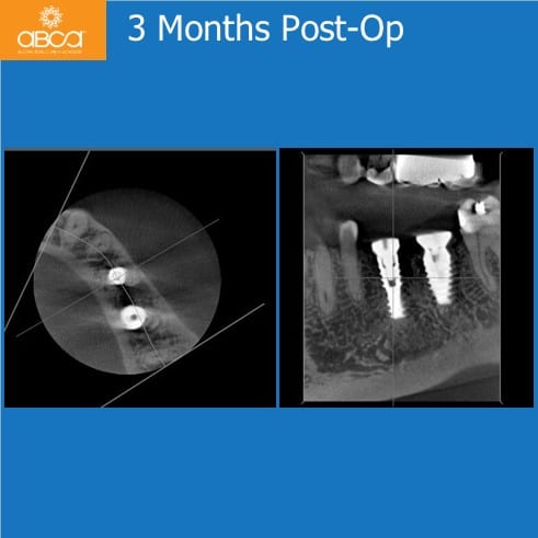 Clinical Case