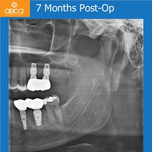 Clinical Case