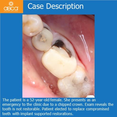 Clinical Case