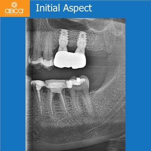 Clinical Case