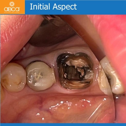 Clinical Case