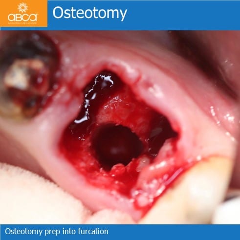 Clinical Case