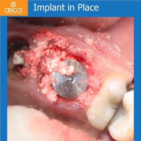 Clinical Case