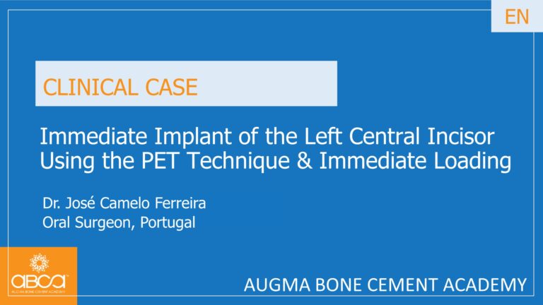 Immediate Implant of the Left Central Incisor Using the PET Technique & Immediate Loading