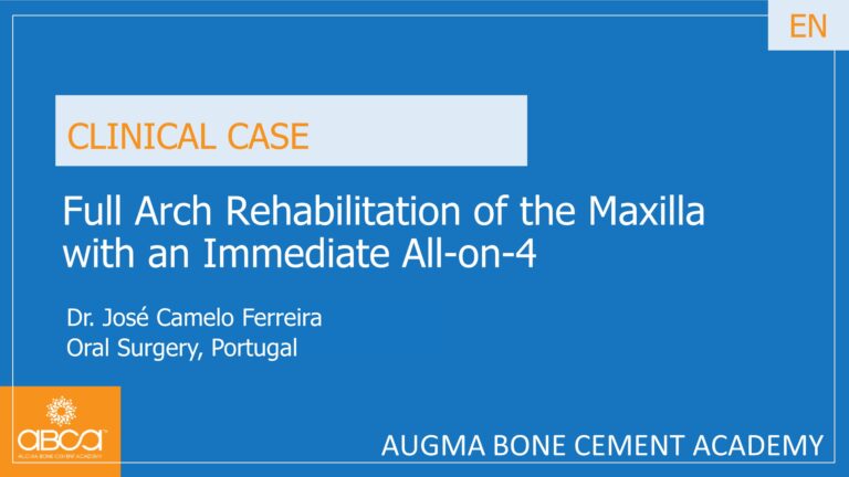 Full Arch Rehabilitation of the Maxilla with an Immediate All-on-4