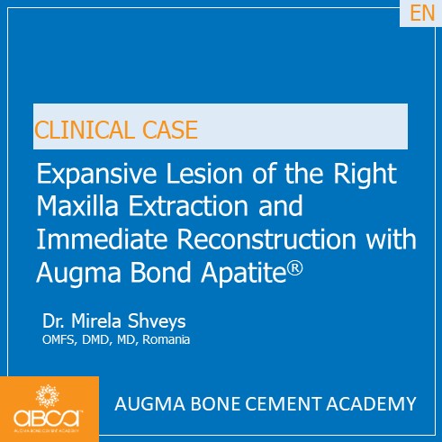 Expansive Lesion of the Right Maxilla Extraction and Immediate Reconstruction with Augma Bond Apatite