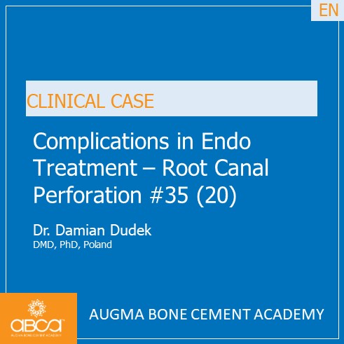 Complications in Endo Treatment  Root Canal Perforation #35 (20)